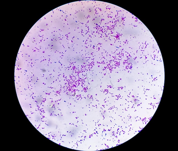 Escherichia coli or e coli gram negative rod shaped\
bacteria