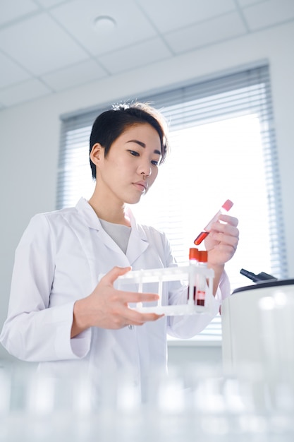 Examining blood sample in lab