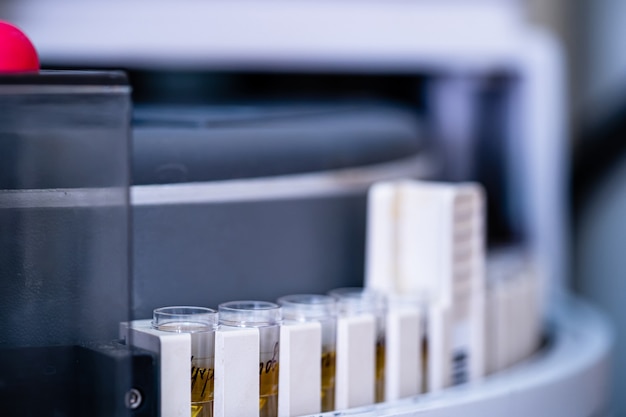 Examining urine in laboratory, closeup. Tubes with urine.