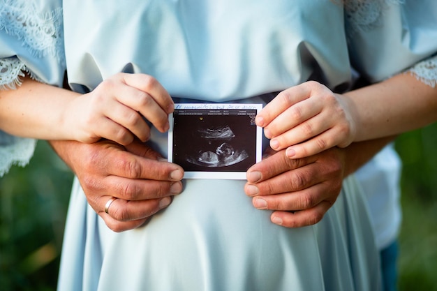 Expectant parents hold an ultrasound photo of a baby in a mother's womb