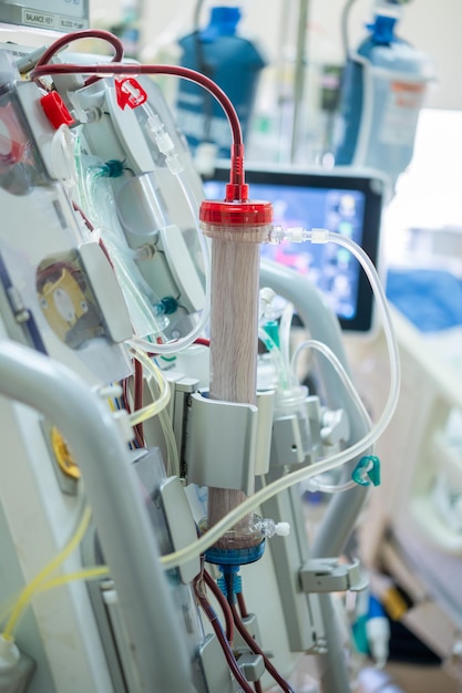 Photo experts are preparing a dialysis machine for use in critically ill patients in hospital intensive care units