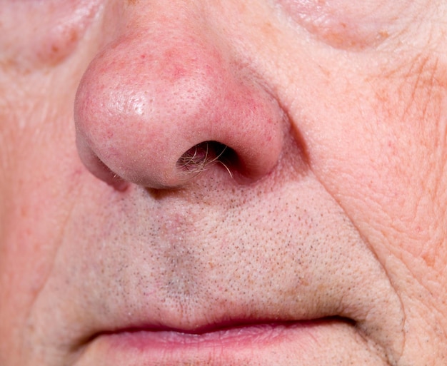 Extreme close-up van senior neus in zijaanzicht