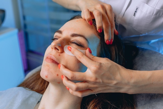 The face of a woman with a close-up of which cooling patches are placed under her eyes to reduce bags under her eyes.