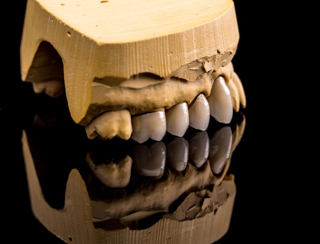 False teeth