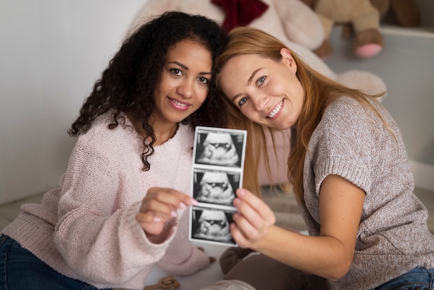 Photo family of two mums having a baby