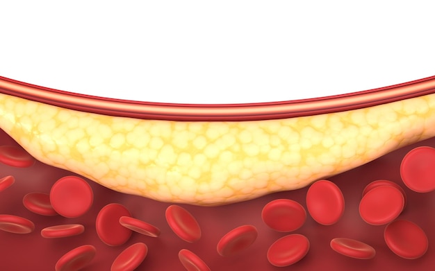血管の 3 d レンダリングの脂肪と赤血球