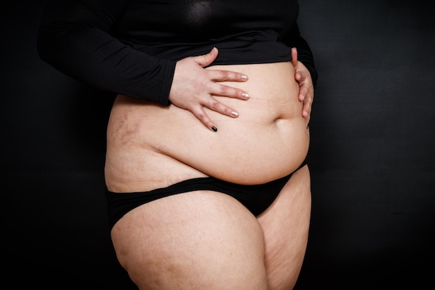 黒の背景に彼女の腹を保持しているセルライトを持つ太った女性高品質の写真