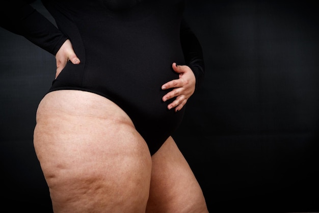 A fat woman with cellulite stands sideways on a black\
background high quality photo