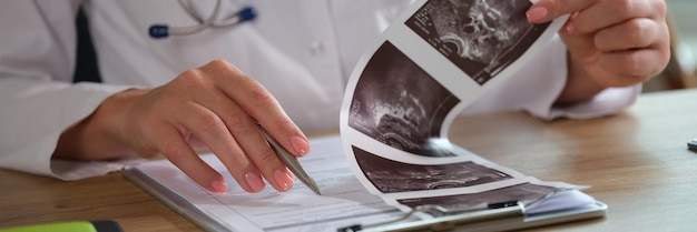 Female doctor analyzes ultrasound results for patient diagnosis a woman working with medical