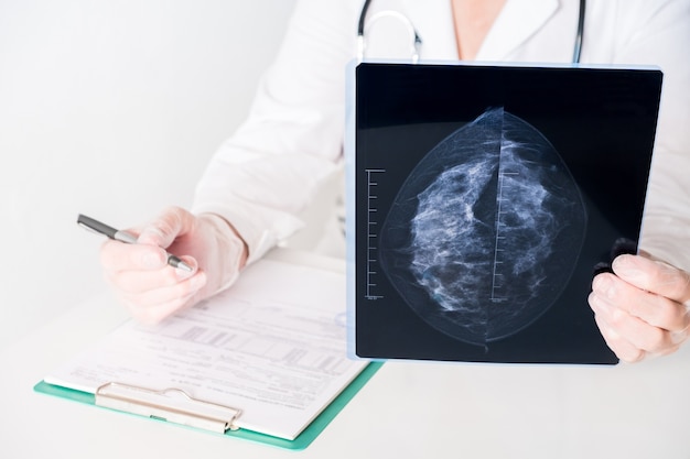 Female doctor analyzing mammography results on x-ray