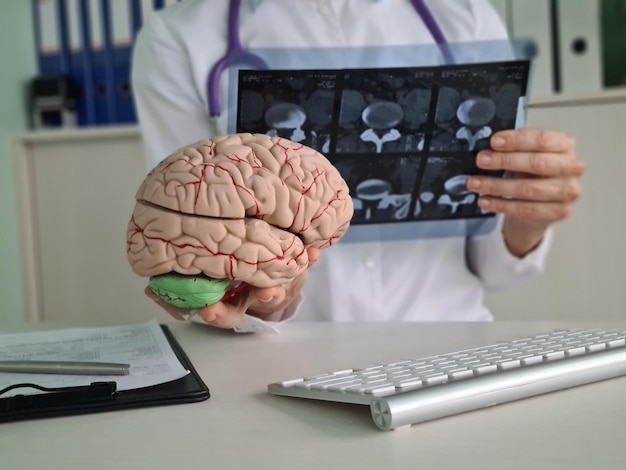 Female doctor examines xray of brain in clinic