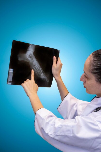 Foto una dottoressa che esamina una radiografia della caviglia