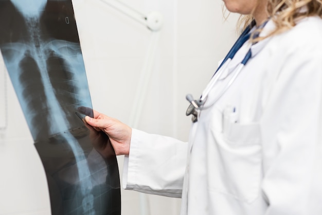 Female Doctor examining a radiography