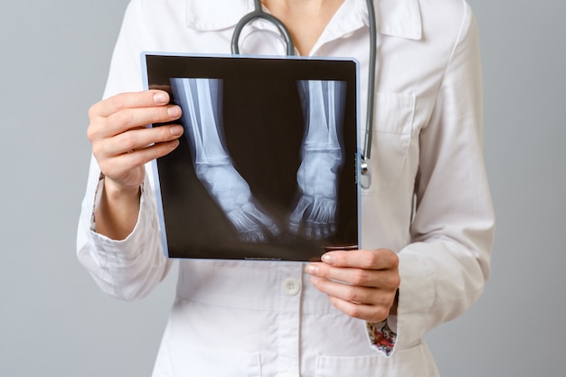 Female doctor examining x-ray image of legs of newborn baby