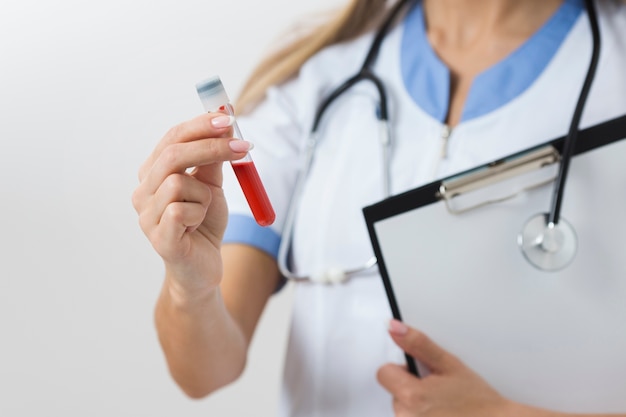 Foto mani femminili del medico che tengono una lavagna per appunti e un campione di sangue