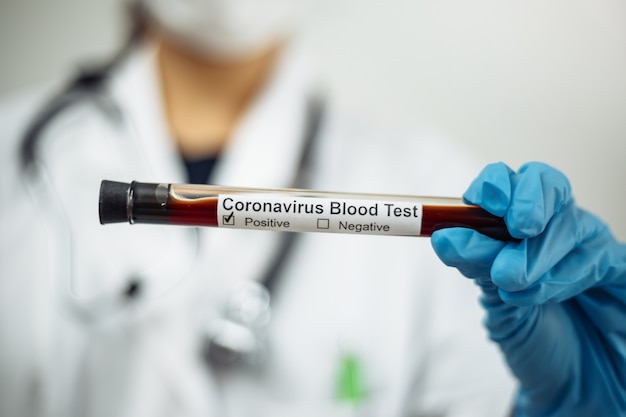 Female doctor in her uniform with a Coronavirus blood test