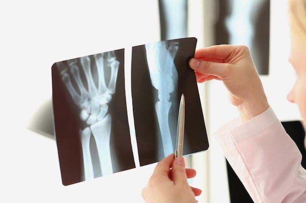 Female doctor looks at xray of a arm injury in hospital