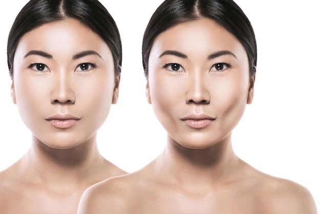 Female face comparison after buccal fat extraction plastic surgery