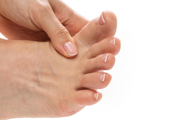 Female feet with itchy skin affected by fungal infection