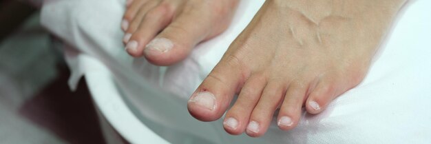 Photo female feet with polished nails on pedicure closeup