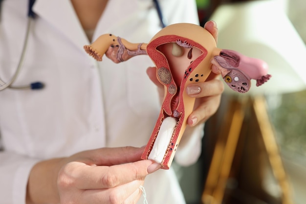 Photo female gynecologist demonstrating model of female reproductive system and hygienic tampon women