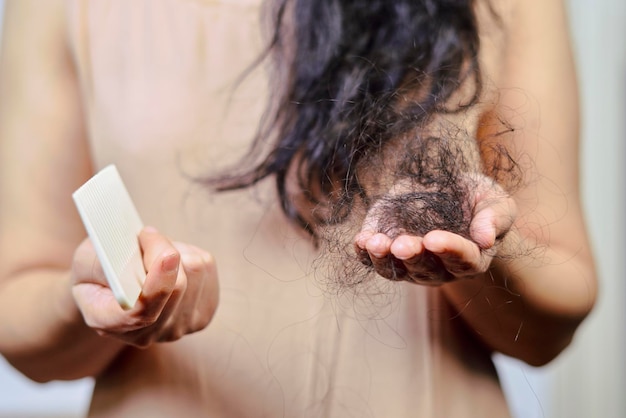 Female hairloss problems