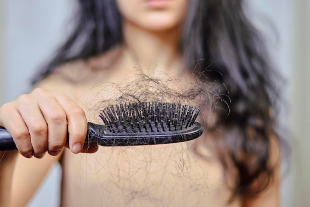 Female hairloss problems