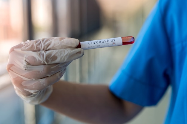 Female hand holding test tube with blood positive marked corona