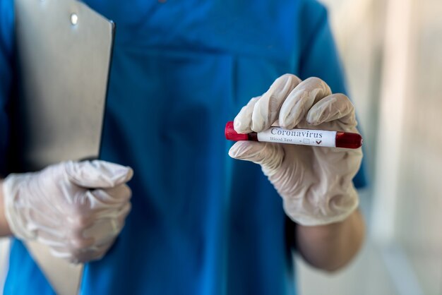 Female hand holds infected blood vial