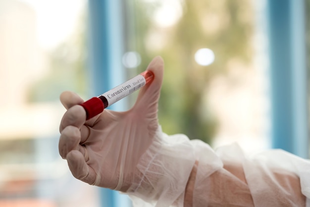 Female hand holds test tube with blood sample