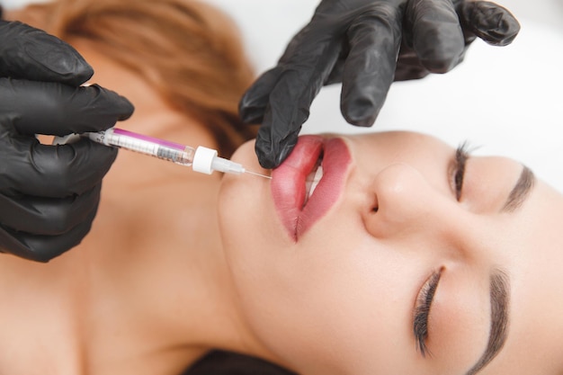 Female lips lip augmentation procedure A syringe near a woman's mouth injections to increase the shape of the lips