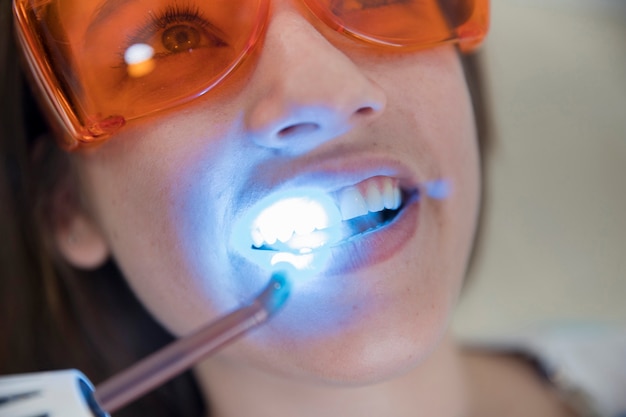 Photo female patient with safety protective glasses going through laser teeth whitening in clinic