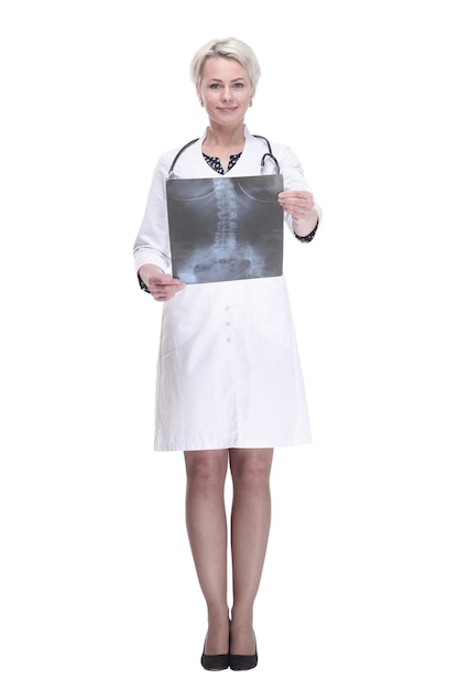 Фото Женщина-врач с рентгеном легких изолирована на белом фоне
