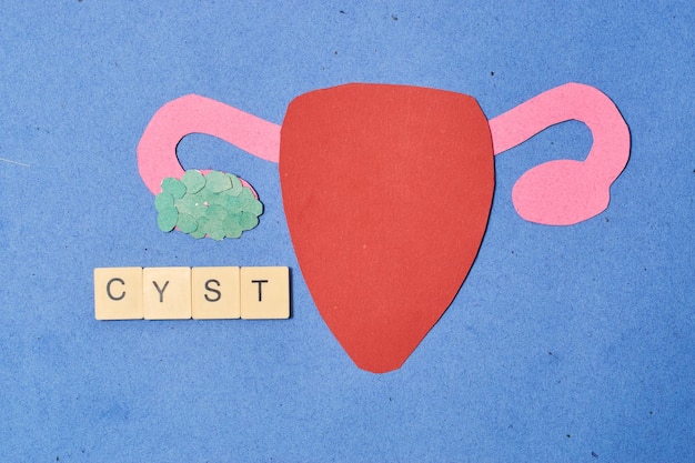 Photo female uterus made of paper with cyst concept ovarian cyst