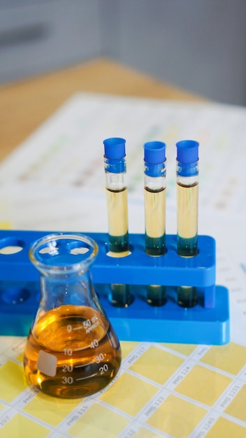 医療用配色の尿の入ったフラスコと試験管。実験室分析、pH制御の概念。縦の写真