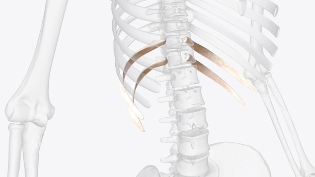 写真 浮遊する肋骨は脊椎肋骨とも呼ばれます