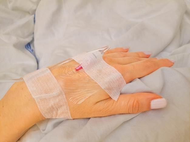 Фото Сосредоточьтесь на женской руке пациента с медицинской капельницей или капельницей в больнице