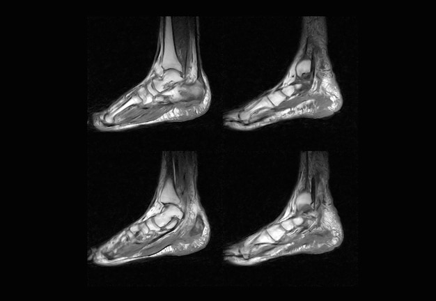 Foot MRI and ct scan xray image