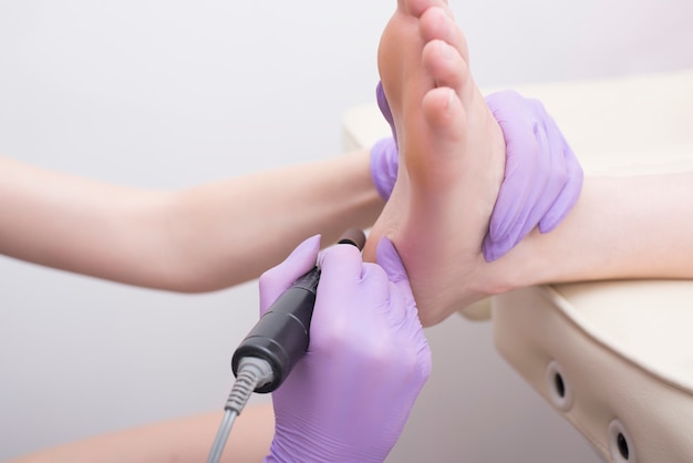 Процесс лечения кожи ног. Руки в перчатках с педикюрным аппаратом. Крупный план