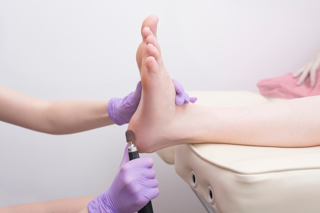 Foot skin treatment process