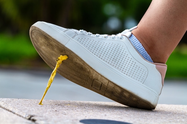 Foot stuck into chewing gum on street