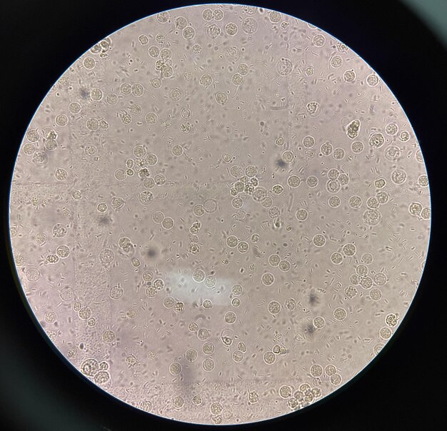사진 소변 플에 있는 신선한 박테리아 세포
