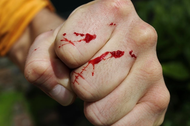 Photo fresh wounds bleeding cat claw scratch lacerated cut fingers young middle-aged mans left hand fist