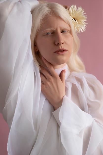 Front view woman with albinism posing in studio