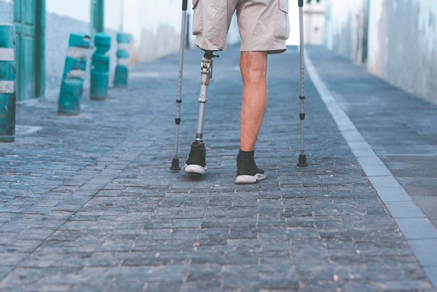 a full member of society an elderly man with a titanium prosthetic left leg walks smoothly in a city park