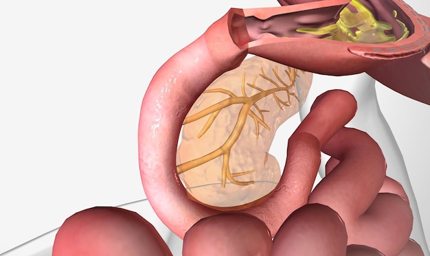 What Happens If You Don't Eat Low-Fiber Diet Before Colonoscopy