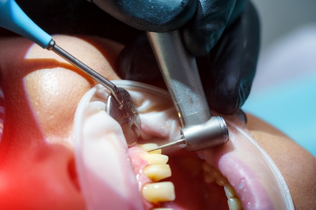 Geduldige vrouw bij de afspraak van de tandarts De tandarts injecteert het medicijn in het harde tandvleesweefsel en zorgt voor een snel effect van anesthesie