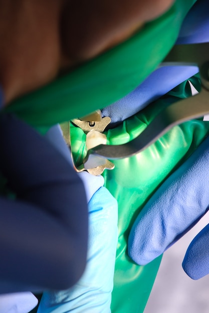 Geïsoleerde tand, tandarts bereidt zich voor om de patiënt te behandelen