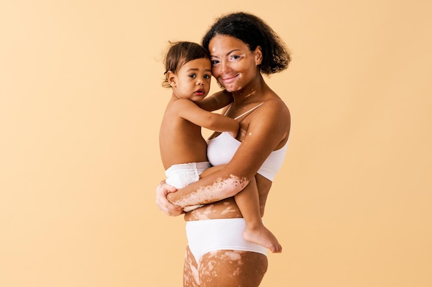 Gelukkige zwarte vrouw met vitiligo die haar baby op gekleurde achtergrond houdt - Jonge vrouw die ondergoed draagt dat voor haar zoontje zorgt - Zwangerschap, moederschap, mensen en verwachtingsconcept