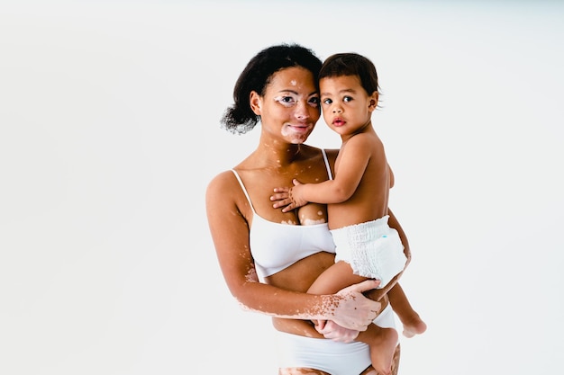 Gelukkige zwarte vrouw met vitiligo die haar baby op gekleurde achtergrond houdt